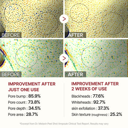 Peel Shot | Rice Peeling Glow Serum