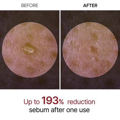 Peel Shot | Rice Peeling Glow Serum