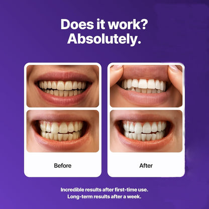 Before and after comparison of teeth whitening with a purple background and text.